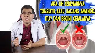 APA SIH SEBENARNYA RADANG AMANDEL ATAU TONSILITIS DAN APA GEJALANYA - DOKETR SADDAM ISMAIL