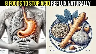 8 Foods To Stop Acid Reflux Naturally