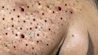 𝐄𝐧𝐣𝐨𝐲 𝐭𝐡𝐞 𝐬𝐮𝐫𝐩𝐫𝐢𝐬𝐞 𝐟𝐫𝐨𝐦 𝐋𝐨𝐚𝐧𝐍𝐠𝐮𝐲𝐞𝐧 
