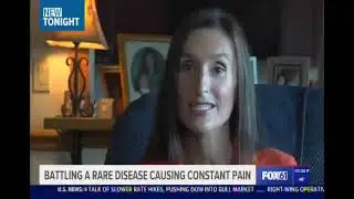 CRPS (Complex Regional Pain Syndrome - Dr. Javeed Sukhera