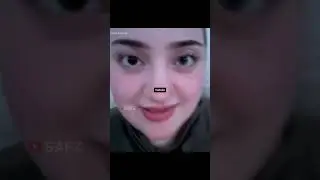 Wow.. Ini dia pemilik mata langka di dunia!