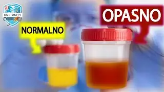Što Boja Urina Otkriva o Vašem Zdravlju #Dr 106