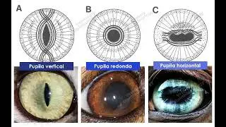 Tema 6 Diferenciales en la presión intraocular (Traducción Español)