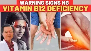 9 Warning Signs na Kulang Ka sa Vitamin B12 - By Doc Willie Ong