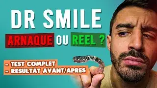 MON AVIS SUR DR SMILE 2025 : TEST, CONSEILS ESSENTIELS ET RESULTAT AVANT/APRÈS