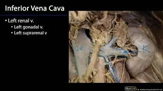 Inferior Vena Cava -  Duodenum, Pancreas and Abdominal Aorta SDV