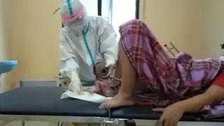 persalinan lilitan tali pusat tanpa mengedan anak ke 4