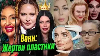 Жертви пластики. ТОП-10 зірок, які не змогли ВЧАСНО ЗУПИНИТИСЬ