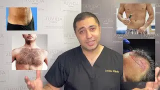 Can Pubic Hair Be Transplanted To The Scalp? | Juvida Clinics