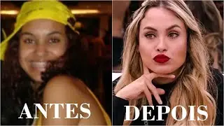 Sarah BBB 21 Antes e depois   Cirurgia Plástica e Harmonização Facial