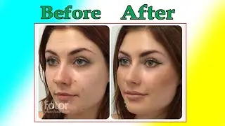 Perfect Photo Editing With Fotor || Face  Pretouch