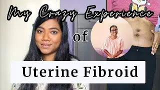 Massive Fibroid Tumors Journey | My Symptoms, Diagnosis, and Lap-Myomectomy (IT HAPPENED TWICE!!!)