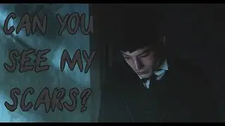 Credence Barebone (+Graves) - Can you see my scars? [Fantastic Beasts and WTFT]