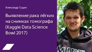 Kaggle Data Science Bowl 2017: выявление рака лёгких на снимках томографа — Александр Гущин