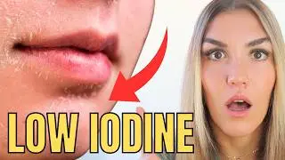 8 Signs of Iodine Deficiency You Might Not Expect