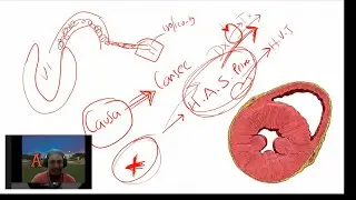 Causas y Consecuencias - Hipertension Arterial e Hipertrofia Ventricular | Clases Fisiología