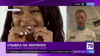 Украшения для зубов