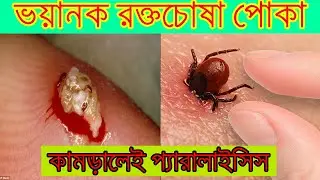 ভয়ানক রক্তচোষা পোকা, কামড়ালে প্যারালাইসিস । Terrible vampire insect, paralysis when bitten