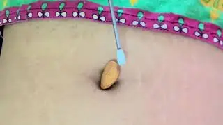 Navel Play Continues 