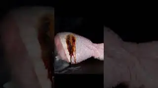 world strongest acid on skin 