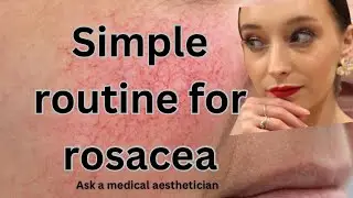 Simple routine for rosacea | Medical aesthetician 🫡✨