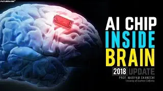 Current State and Future of Brain-Machine Interfaces