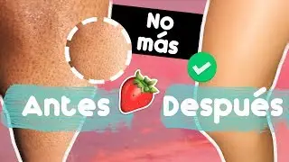 ELIMINA PUNTOS NEGROS DE LAS PIERNAS 👊🍓 ¡BUENAZOOO!