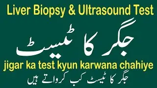 Liver Biopsy & Ultrasound testing|جگر کا ٹیسٹ کب کرواتے ہیں