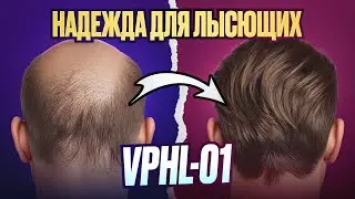Новое средство против облысения работает лучше миноксидила?  | VDPHL01