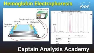 E3. Hemoglobin Electrophoresis  شرح تقنية الفصل الكهربائى للهيموجلوبين medicine