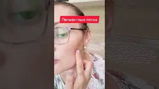 Пигментные пятна больше не проблема! 