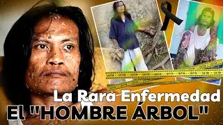 El hombre 