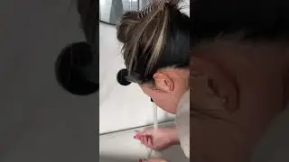 Adult Acne Solved! Before & After SLMD Skincare Results 