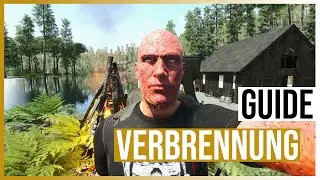 SCUM Guide 0.9 | VERBRENNUNGEN - Post-Behandlung von MR. BRENNER