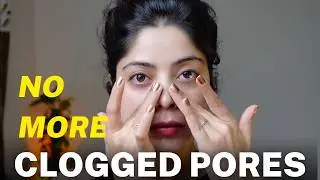 5 Proven Steps to Clear Sebaceous Filaments, Blackheads & Comedonal Acne !