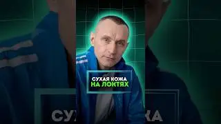 СУХАЯ КОЖА НА ЛОКТЯХ 