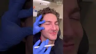 Botox for Men