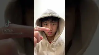 Вырвал заусенец 😰😰🤣