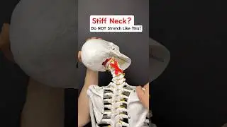 Got a STIFF NECK? Don’t stretch like this! Try this instead! 