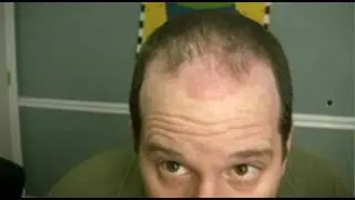 Why the Hat?