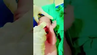 Newborn suctioning video#trending#short#viral