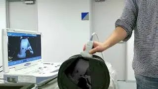 Augmented Reality Echography (Ultrasonography) with Real-time Markerless Probe Tracking