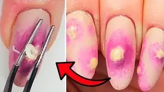 ПРЫЩИ на НОГТЯХ?САМЫЙ БЕЗУМНЫЙ ДИЗАЙН НОГТЕЙ😱Странный маникюр идеи Weird nail art