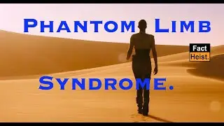 PHANTOM LIMB and PHANTOM PAIN EXPLAINED .
