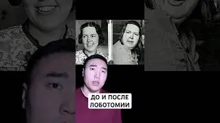 До и После Лоботомии