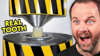 How Strong is a Human Tooth?