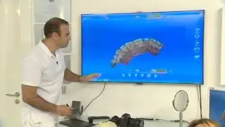 Diş Tedavi Videoları - videos of dental treatment