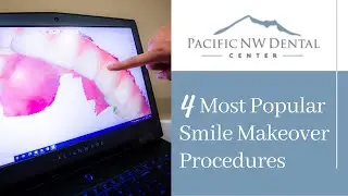 What Are The 4 Most Popular Smile Makeover Procedures?