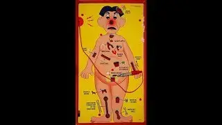 Operation Commercial (1981)
