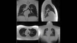 lung imaging with modified Rosette PETALUTE